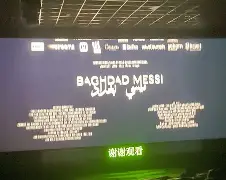 U球-巴塞罗那今晚造点机会关键时刻费耶诺德调整名单以备法国杯之后，里昂围绕意甲伤情更新的简单介绍